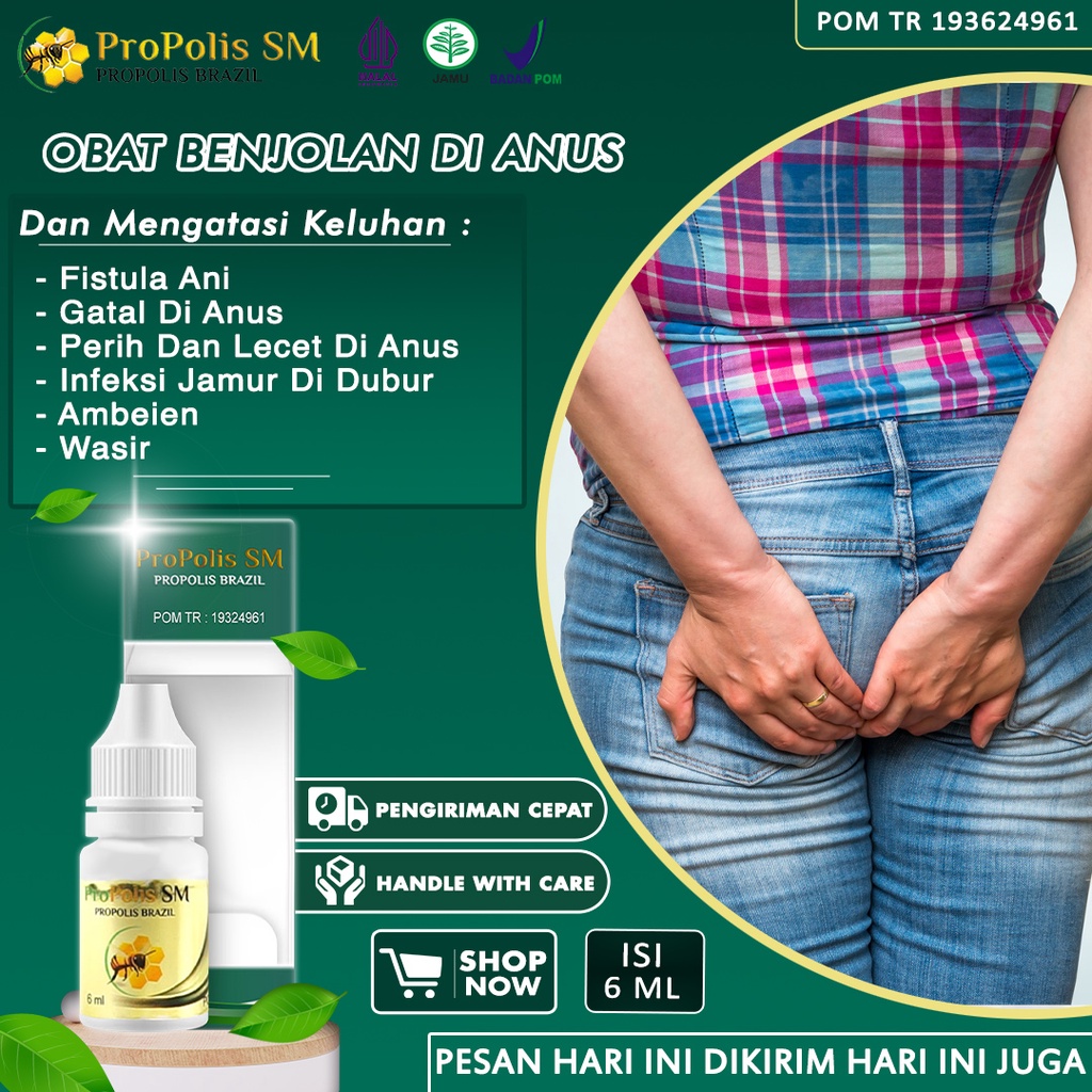 Obat Salep Benjolan Di Anus Fistula Ani Gatal Anus Ambeien Ambeyen Wasir Pantat Burik Bruntusan Herp