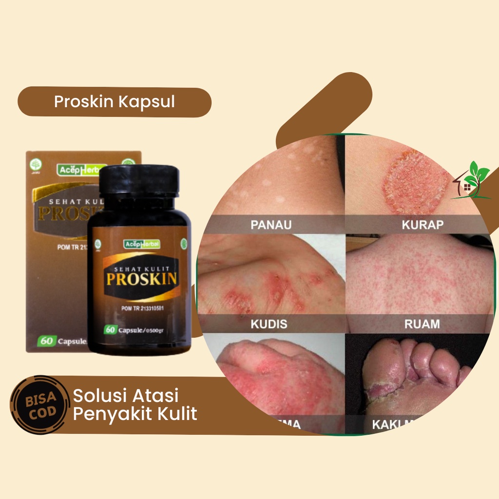 Obat Masalah Kulit, Obat Panu, Obat Jamur Kulit, Obat Kudis, Obat Kurap, Obat Kadas, Obat Ruam Merah