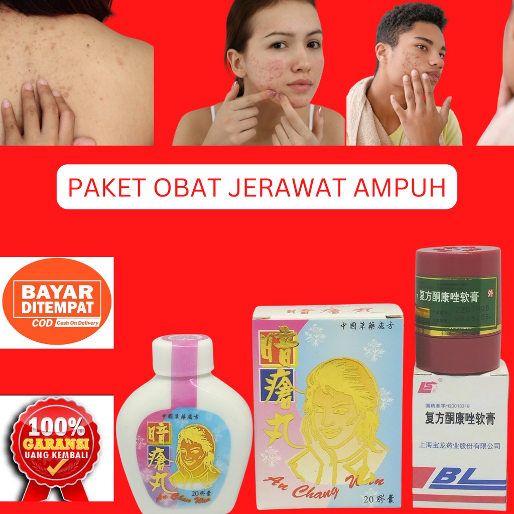 PAKET OBAT JERAWAT - AN CHANG WAN - SALEP BL - OBAT JERAWAT AMPUH