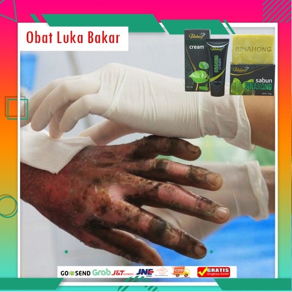 Jual Obat Luka Bakar Obat Bekas Luka Bakar Luka Bakar Melepuh Luka Bakar Air Panas Luka Bakar