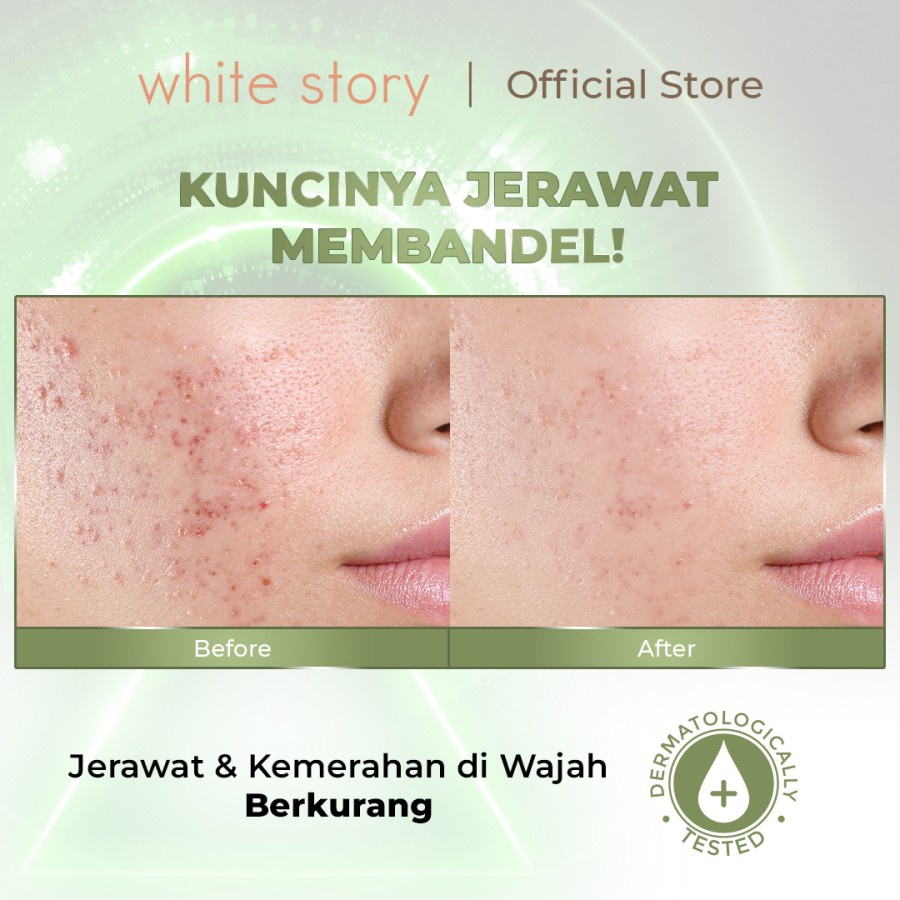 WHITE STORY Acne Night Moisturizer