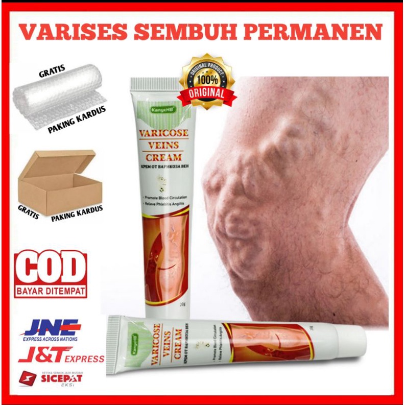 OBAT KAKI VARISES KAKI  PARISES CREAM VEINS CREAM VARICOSETE