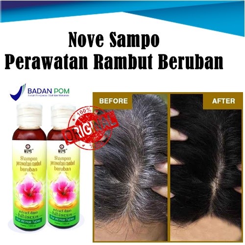 Saku Shampo Nove Shampoo Perawatan Anti Uban Rambut Alami Terbaik Asli Bpom