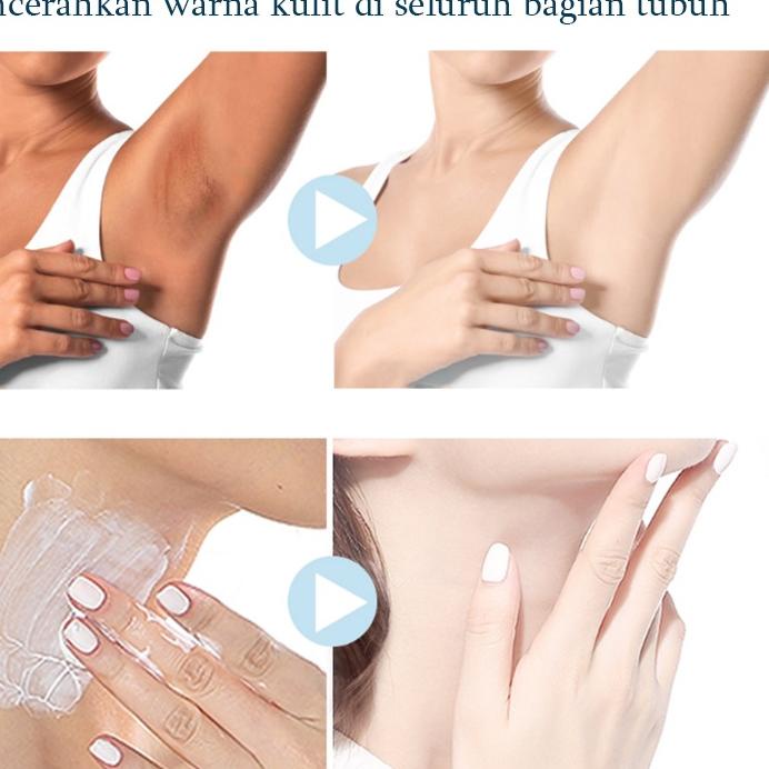 ➧➣✩✸ Pemutih selangkangan Pemutih ketiak Krim pemutih Pemutih tubuh Underarm Whitening cream Perawat
