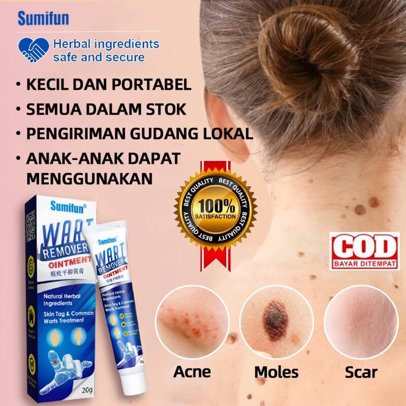 Sumifun Wart Tahi Lalat Skin Tag Remover  Menghilangkan Kutil Mata Ikan Remover Ointment Penghilang 