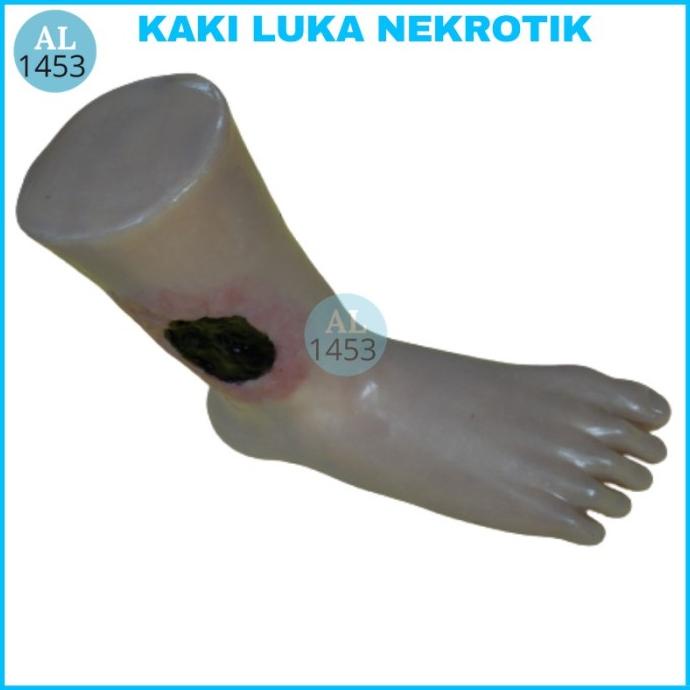 Manikin Model Kaki Luka Nekrotikluka Kronis Alatperaga Phantom
