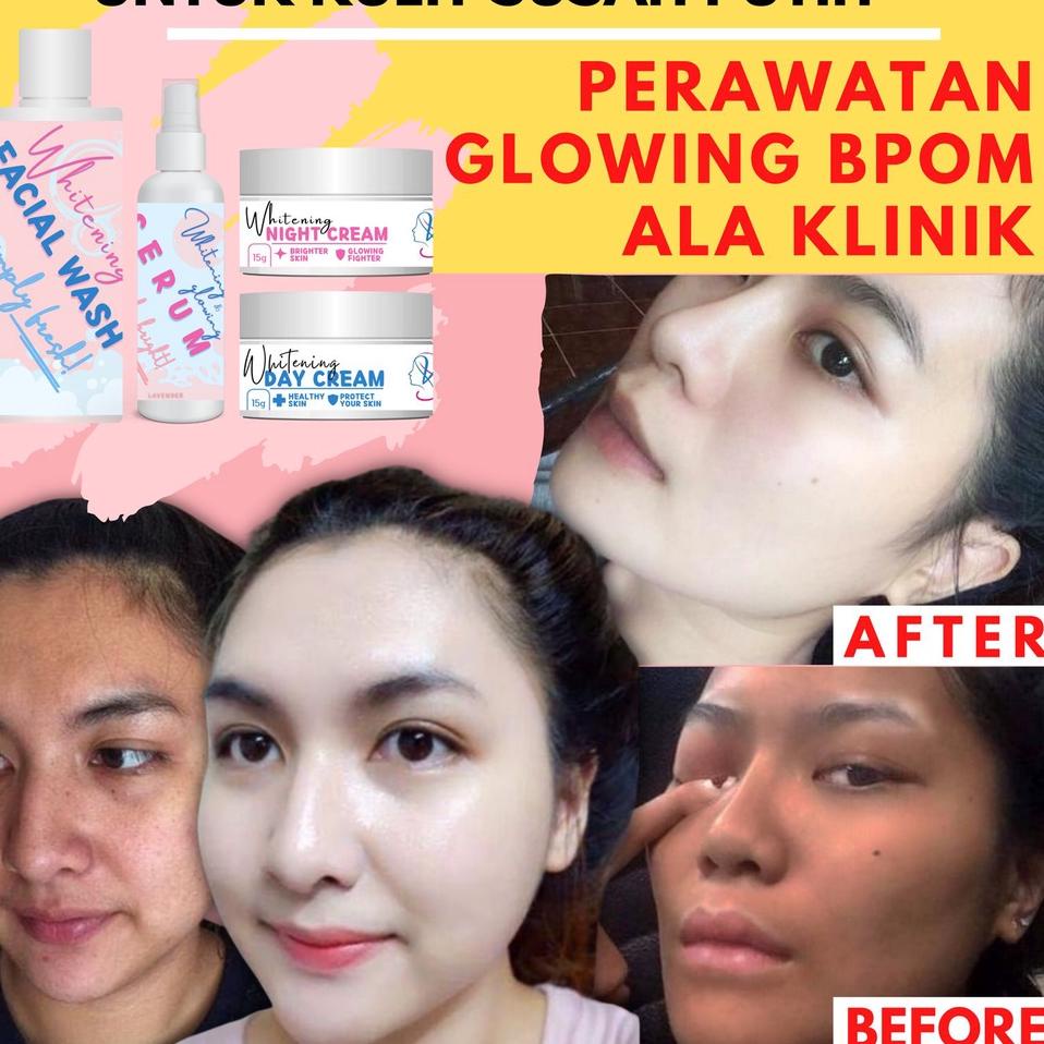 ORIGINAL%  SKINCARE SUSAH PUTIH-Perawatan Wajah Glowing Ala Korea-Cream Glowing Jerawat Flek Kusam b