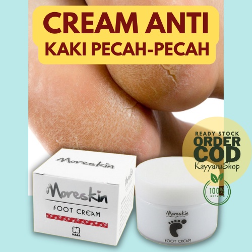 Perawatan Kaki / Cream Kaki Pecah Pecah / Cream Kaki Pecah Kering Ampuh / Krim Obat Kaki Pecah Pecah