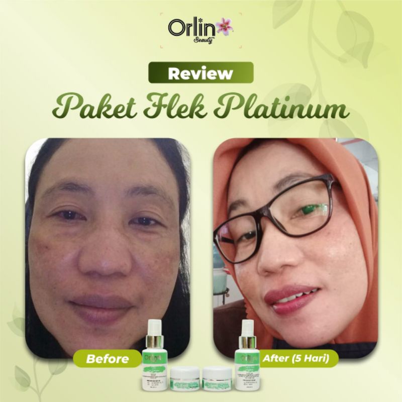 TERLARIS ! ( DAPAT HADIAH GRATIS ) ORLIN SKINCARE / ORLIN BEAUTY SKINCARE / ORLIN / PAKET ACNE / PAKET FLEK / PAKET WHITENING PLATINUM BIKIN WAJAH CERAH PUTIH BERSIH MENYEMBUHKAN JERAWAT BIKIN GLOWING CANTIK