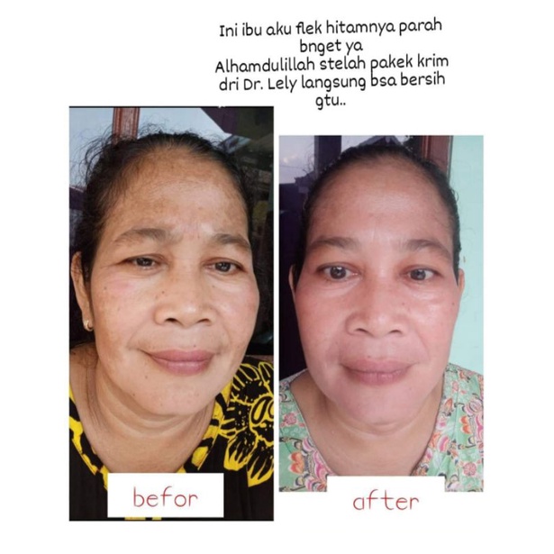 PLATINUM NIGHT CREAM B by dokter//CREAM MALAM DOSIS TINGGI