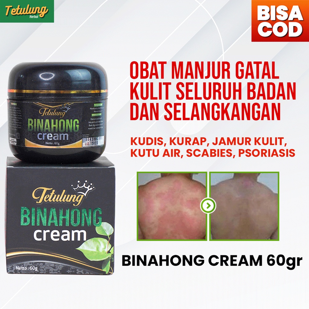 1 Krim/Salep Binahong 60gr Salep Obat Gatal Kulit Paling Ampuh