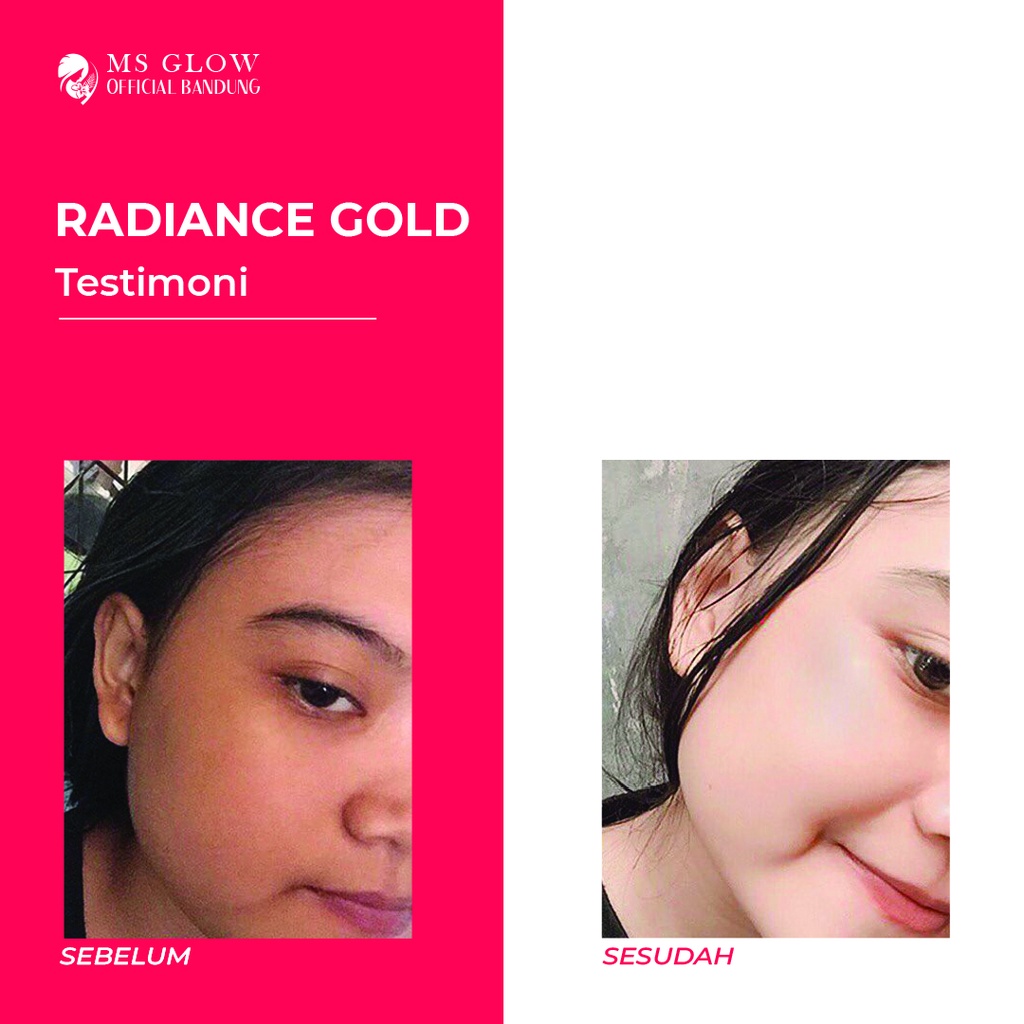 Radiance Gold MS Glow / Pelembab Wajah / Perawatan Kecantikan Berkualitas - By Msglowofficialbandung