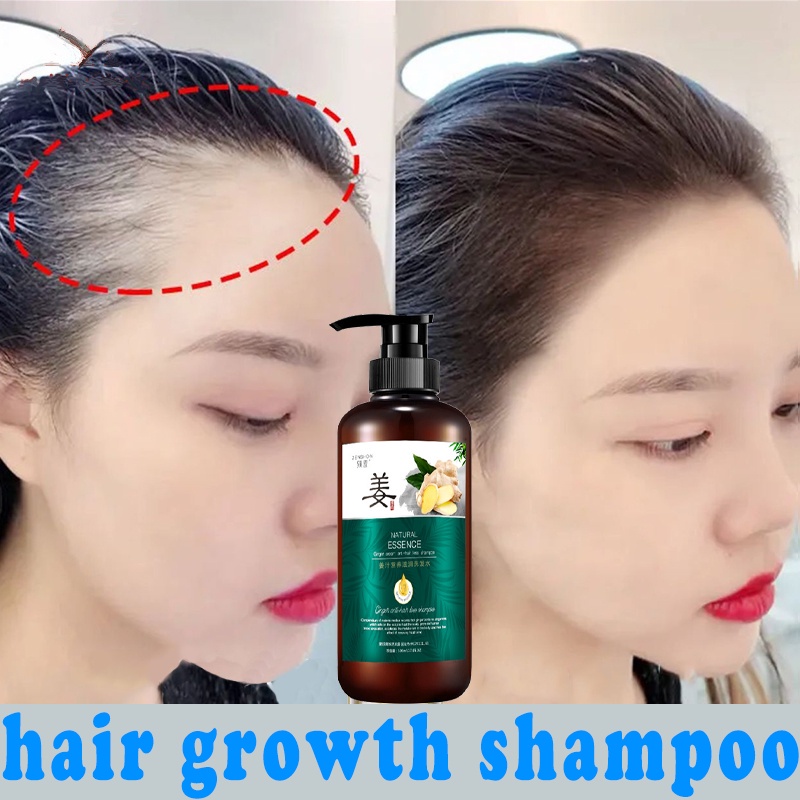 Shampo Penumbuh Rambut Mempercepat Pertumbuhan Shampo Anti Rambut Rontok 500ml Gatal Anti Rambut Rontok Fast Grow Shampoo Perawatan Rambut Rontok