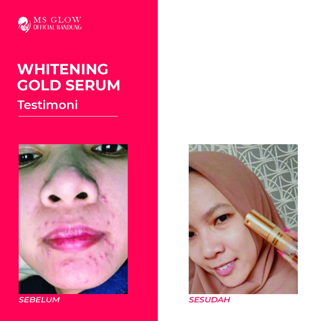 MS Glow Whitening Gold Serum Penghilang Flek Pemutih Wajah MS Glow