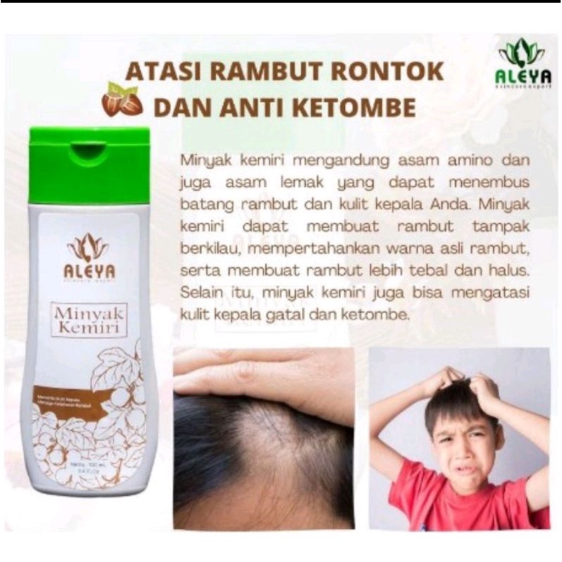 Minyak kemiri penumbuh rambut anti botak  obat kebotakan