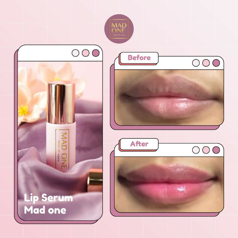 ★ BB ★ Mad One Natural Pink Lip Serum 5ml - Bibir Pink - Perawatan Bibir - Pencerah Bibir