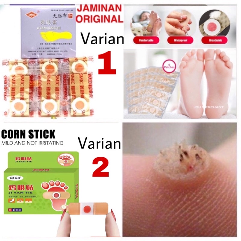 Original Plester Kutil Mata Ikan Kaki Kapalan Ji Yan Gao Obat Kutil Kapalan Mata Ikan Kaki [1 Box