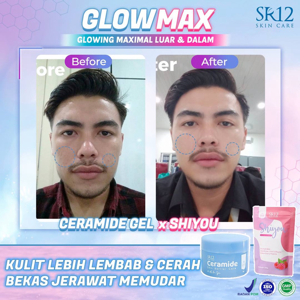 Shiyou Collagen Drink SR12 | Minuman Pemutih Badan Cepat | Glowing Maximal | Colagen Beauty Drink | Suplemen Kecantikan | Minuman Kolagen | Suplemen Makanan | Premium Collagen Drink | Minuman Kolagen Pemutih Badan | Suplemen Pemutih Kulit BPOM | Madu SR12