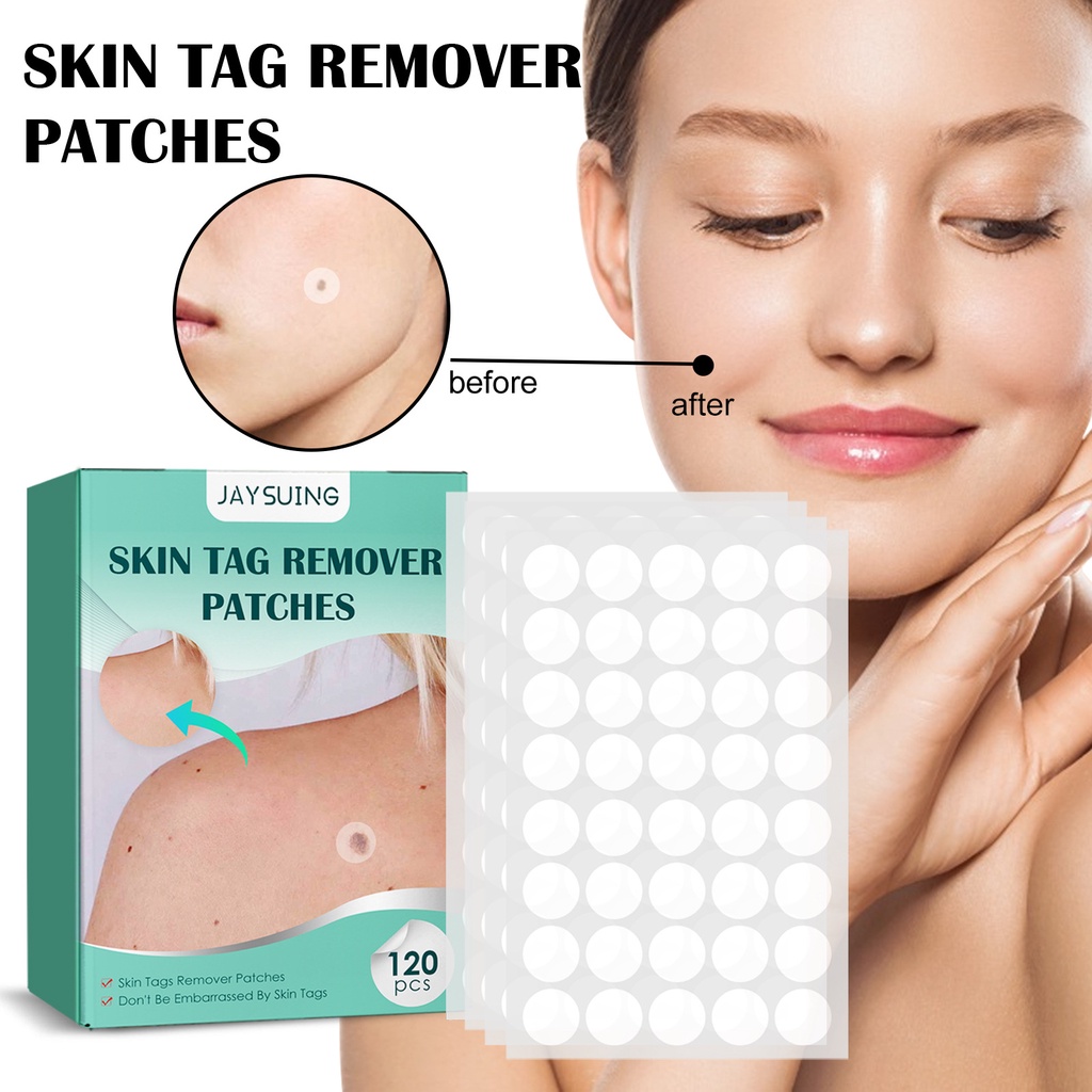 【120 PCS】Patch Menghilangkan Kutil Tahi Lalat/Stiker Plester Penghilang Kutil/Patch Wart Removal/Skin Tag Remover Patch