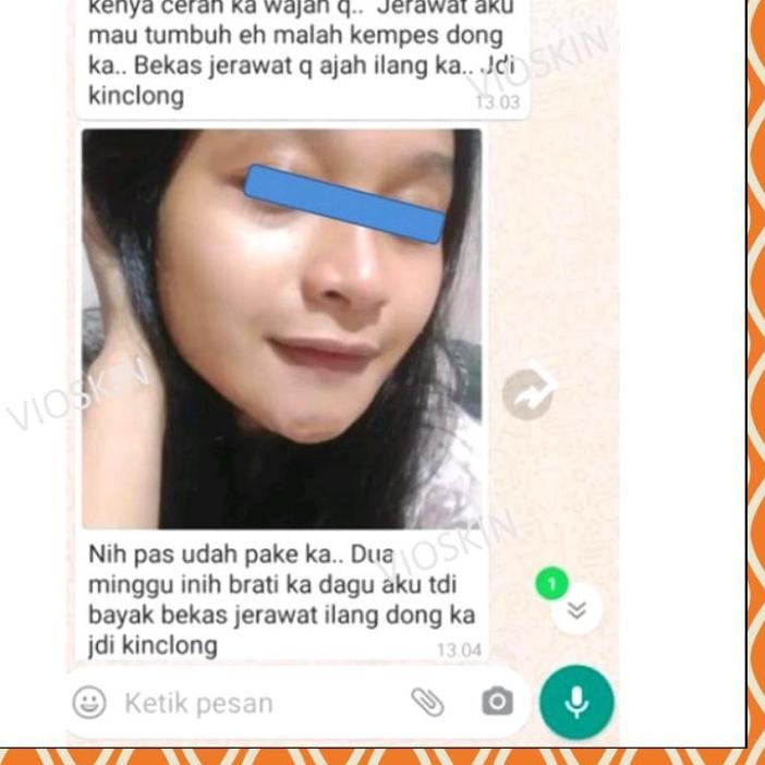Update바 Vioskin Anti Acne Serum Penghilang Jerawat Paling Ampuh Penghilang Bekas Jerawat Batu Pasir 