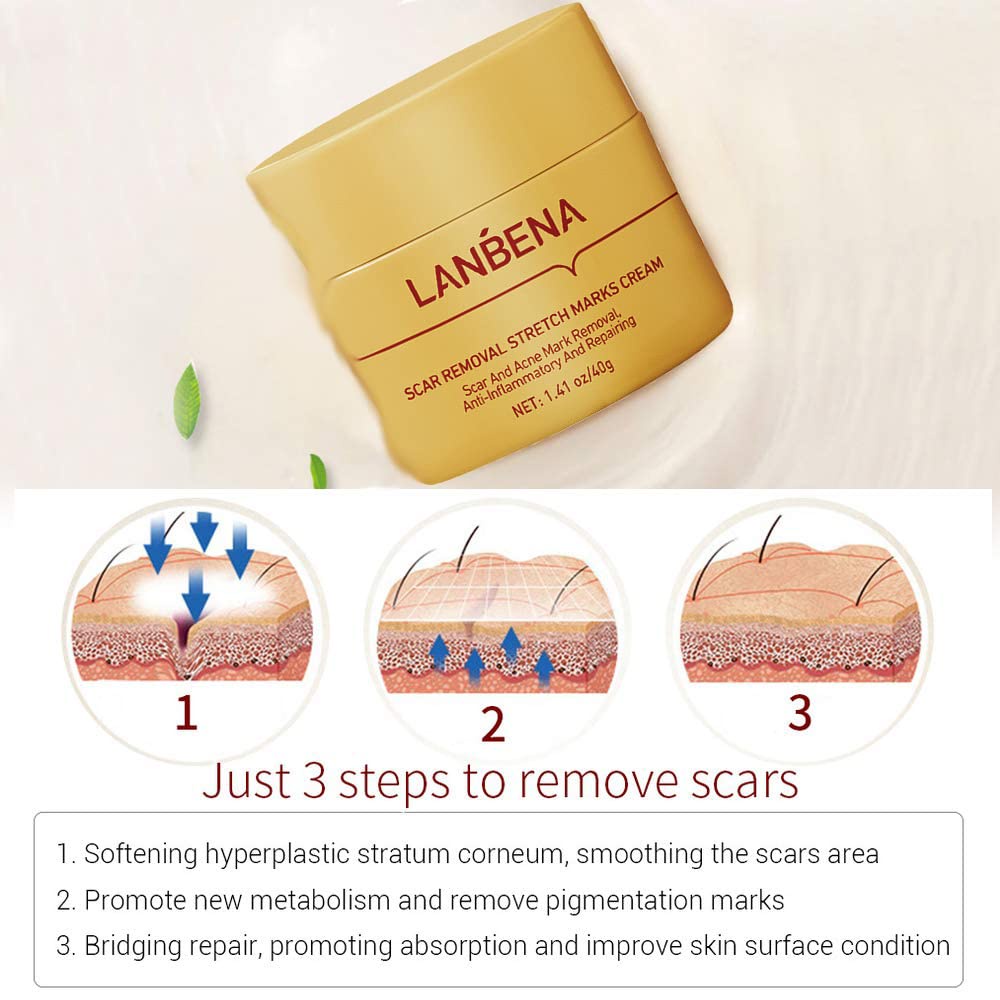 (READY &amp; ORI) LANBENA Scar Removal &amp; Strechmark Cream LB6245