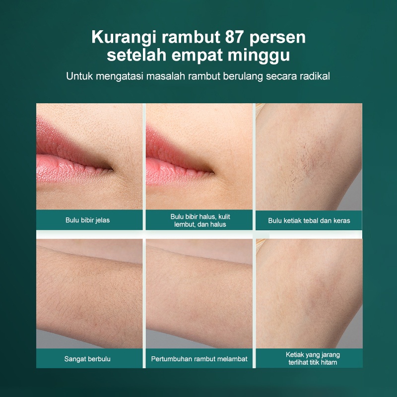 IPL Hair Removal Laser Penghilang Bulu / Artefak Penghilang Bulu Foton Portabel untuk Peremajaan Kulit Seluruh Tubuh Pria dan Wanita