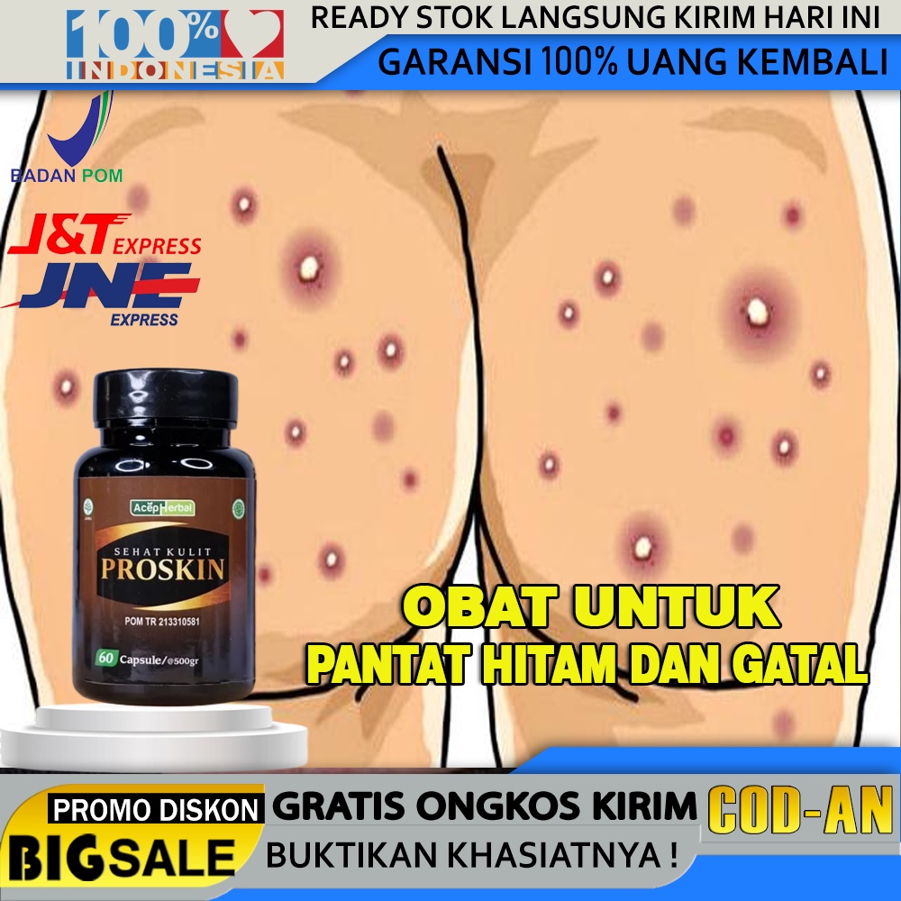 Jual Obat Pantat Gatal Bentol Bentol Merah Di Pantat Obat Bokong Hitam Ruam Di