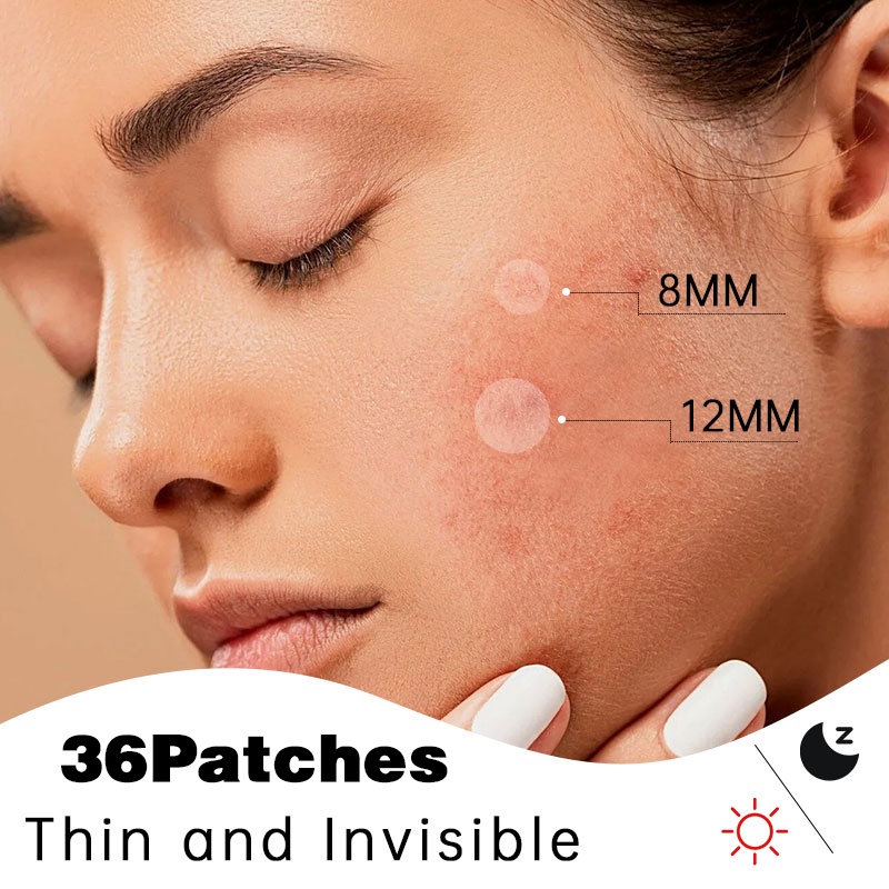 Acne Pimple Patch/Patch Jerawat Anti Jerawat/Stiker Penghilang Jerawat(36 Patches)