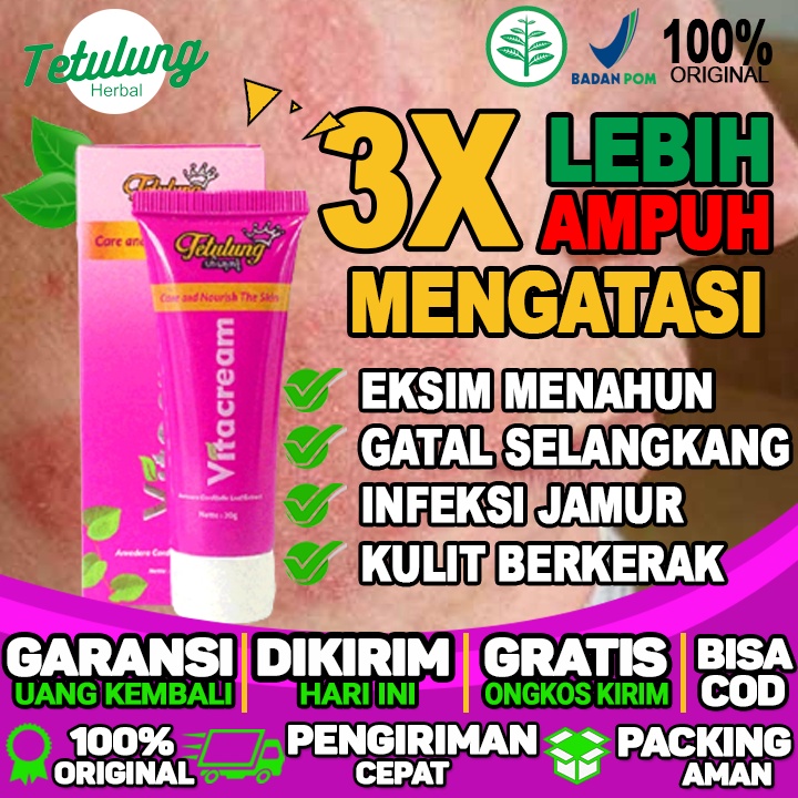 Obat Oles Menghilangakan gatal gatal di wajah dan bintik bintik merah di wajah