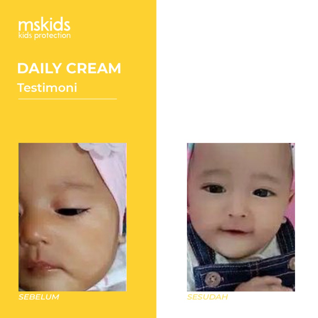 MS Glow Kids Original Daily Cream MS Kids by ms.officialbandung