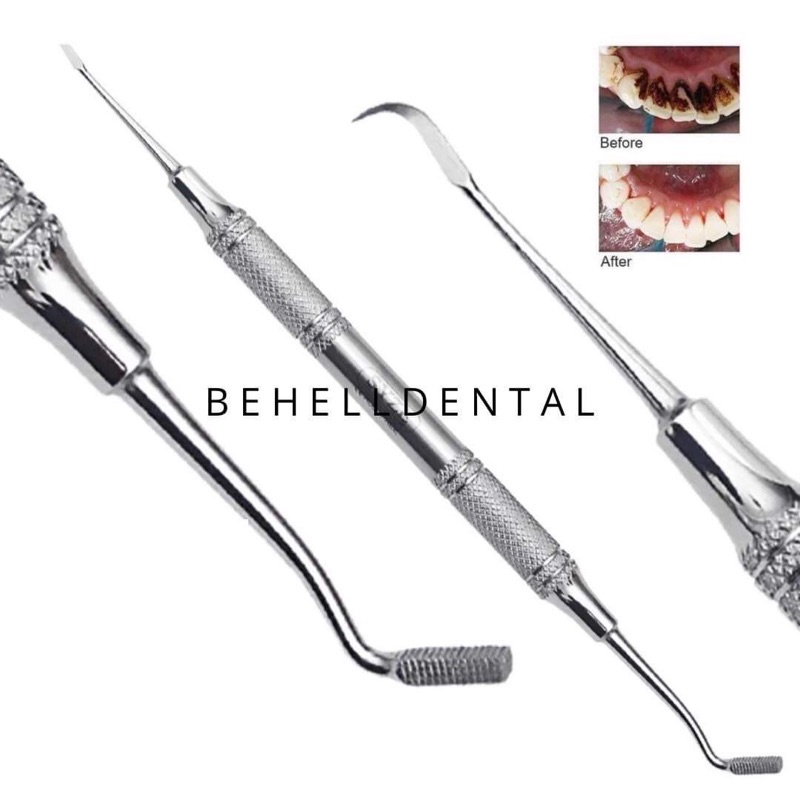 ALAT PENGIKIS PEMBERSIH LEM BEHEL dan Penghilang Plak Karang Gigi INSTRUMENT DENTAL BAND SEATER MK. 556 - Alat Pembersih Penghilang Sisa Lem / Penghilang Karang Gigi Plak - Penekan Molar Band - Braces Kawat Ortho Orthodontic Behelldental