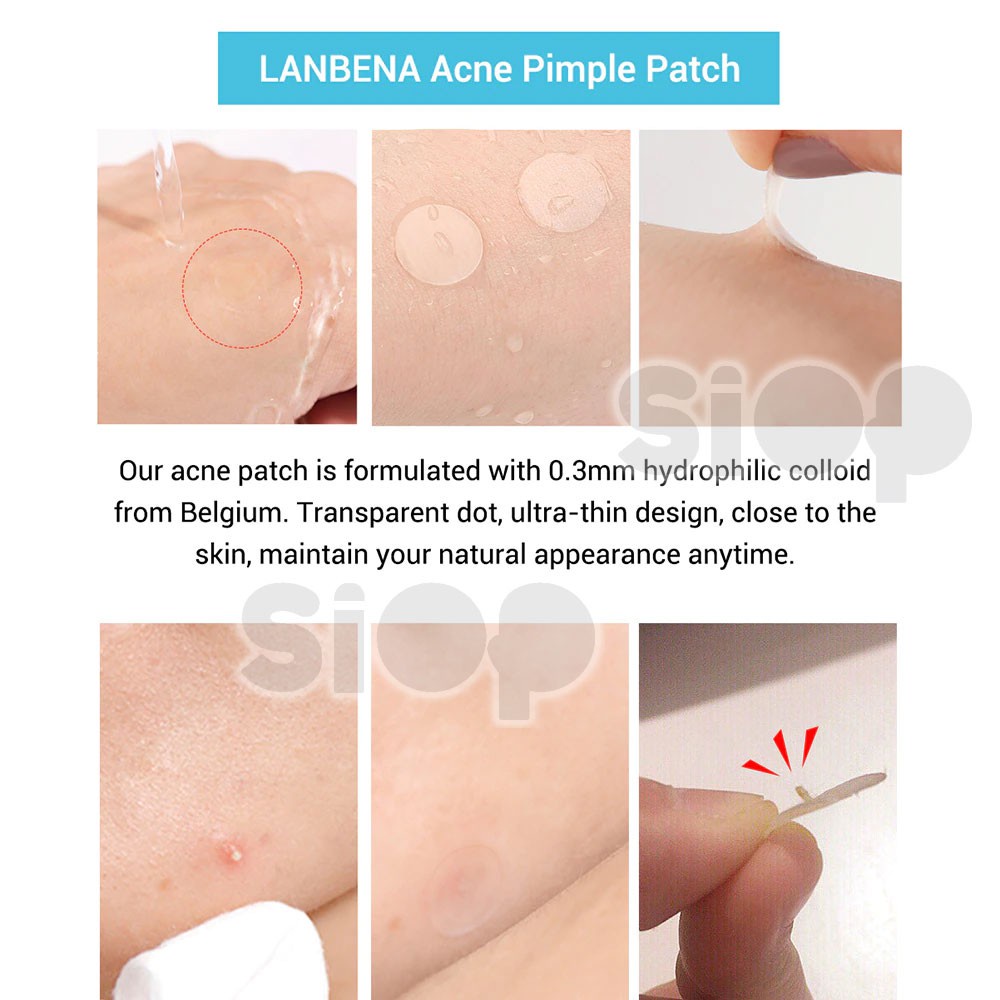 (READY &amp; ORI) LANBENA ACNE PIMPLE PATCH DAY NIGHT LB0700 0717