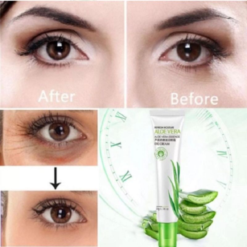 Eye Cream Penghilang Mata Panda Dan Kerutan Kantung Mata Hitam Ampuh Aloevera 20gr Original Import Bpom