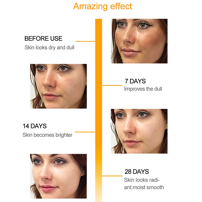 Vitamin C Face Serum Whitening Brightening Freckle Fade Dark Spot Removal Pigment Melanin Correcting Essence 30ml