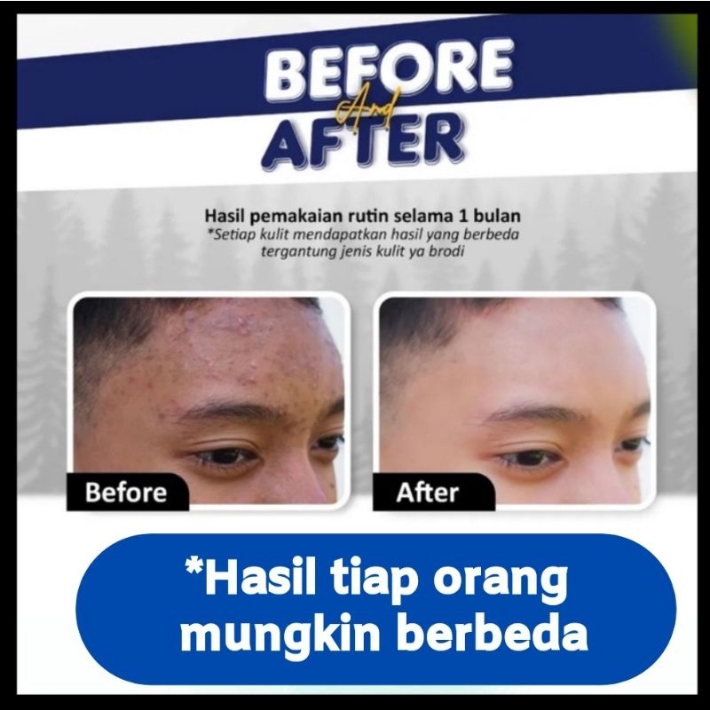 𝗕𝗥𝗢𝗠𝗘𝗡 𝗦𝗔𝗕𝗨𝗡 𝗖𝗢𝗪𝗢𝗞 2 𝗣𝗖𝗦 𝗦𝗔𝗕𝗨𝗡  1 SERUM 2 TPT SABUN