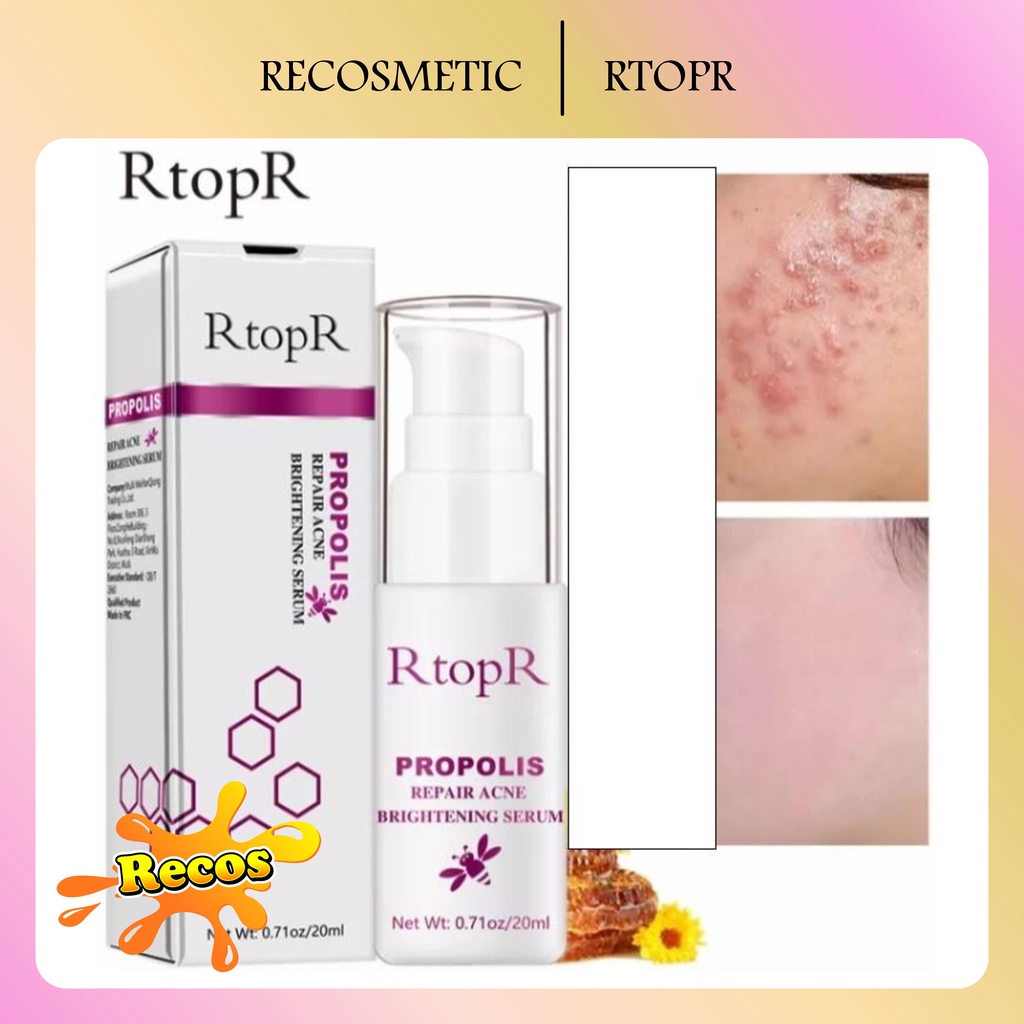 RtopR PROPOLIS Repair Acne Brightening Serum BRIGHTENING SERUM / JERAWAT / MENCERAHKAN