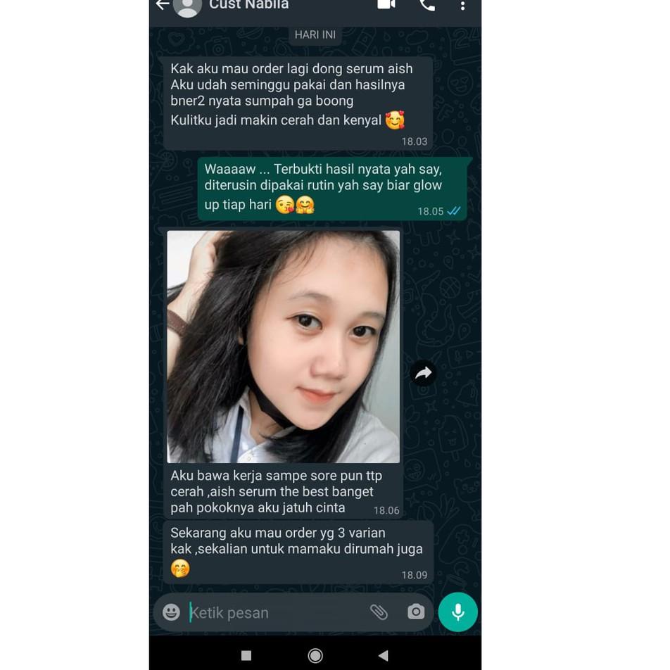 Gebyar promo--Aish Darkspot Serum (menyamarkan flek hitam) original 15ml