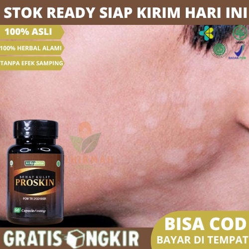 Obat Panu, Obat Gatal Panu, Obat Panu Gatal, Obat Penyakit Kulit Panu, Obat Panu Di Wajah, Obat Panu