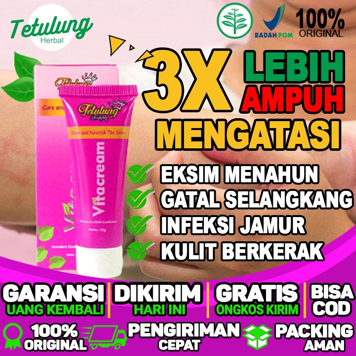 Obat Salep menghilangkan gatal dan infeksi jamur pada tubuh dan mengurangi gatal gatal