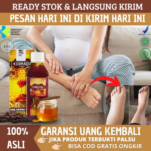 Kurmaqu  GMJ - Obat Kaki Bengkak Pada Ibu Hamil, Obat Kaki Bengkak, Obat Untuk Kaki Bengkak Pada Ibu