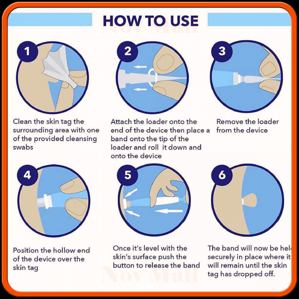 Alat Penghilang Kutil Painless Skin Tag Mole Removal Kit -BY006