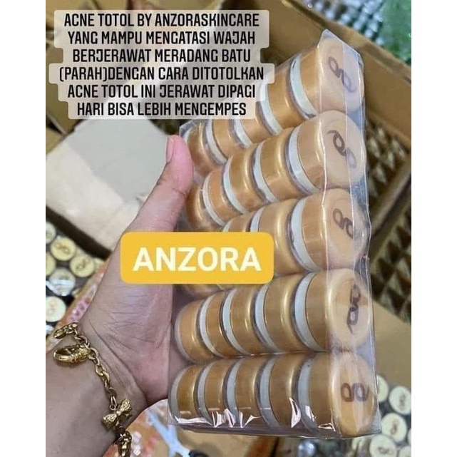 Totol acne anzora