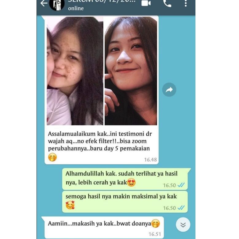 [KODE PRODUK RHVDH6839] SERUM ADERA FACE SERUM ORIGINAL WAJAH ORI UNTUK FLEK HITAM GLOWING ORI BPOM 