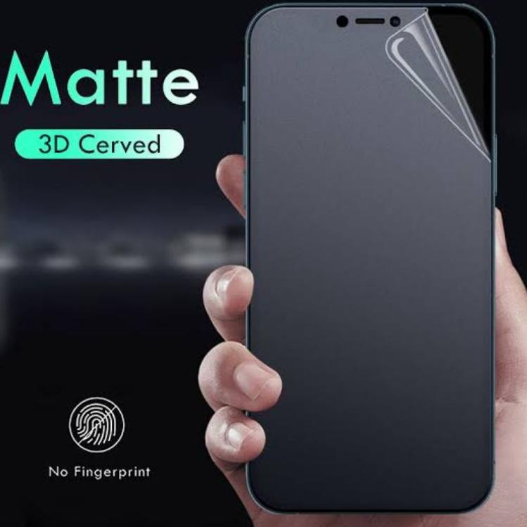 STOK BANYAK 9938 Hydrogel GLARE Matte Doff Front/Back Oppo F1S/A71/A83/A57/A37/A39/A3S/A7/R7/R7+/F1/