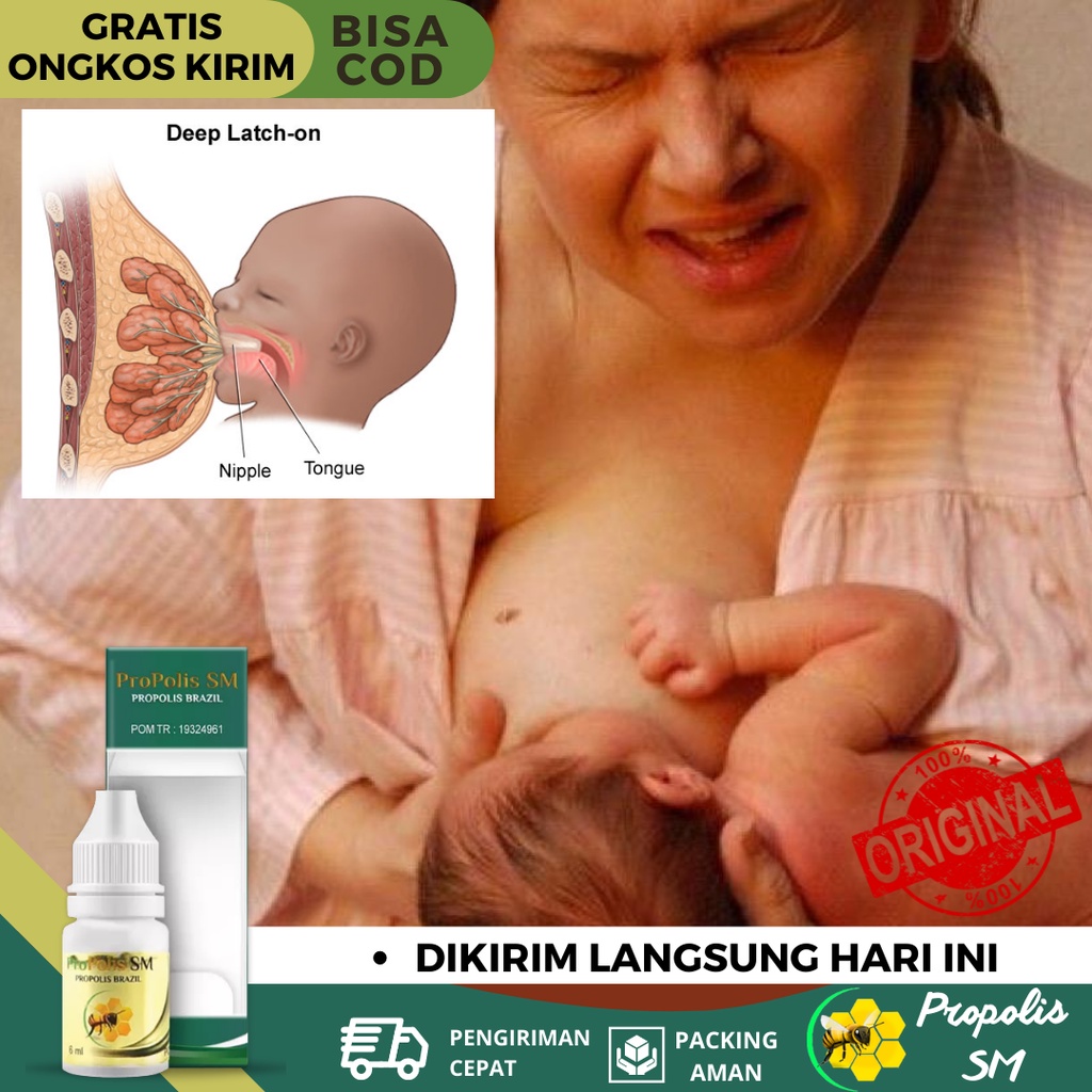 Obat Nyeri Puting Susu, Obat Puting Susu Lecet, Obat Puting Susu Luka Akibat Menyusui, Obat Mastitis