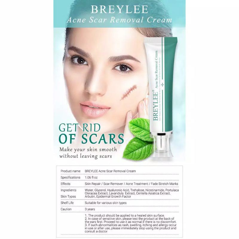 Breylee Acne Scar Removal Cream Menghilangkan Bekas Luka / Stretch Marks 30g