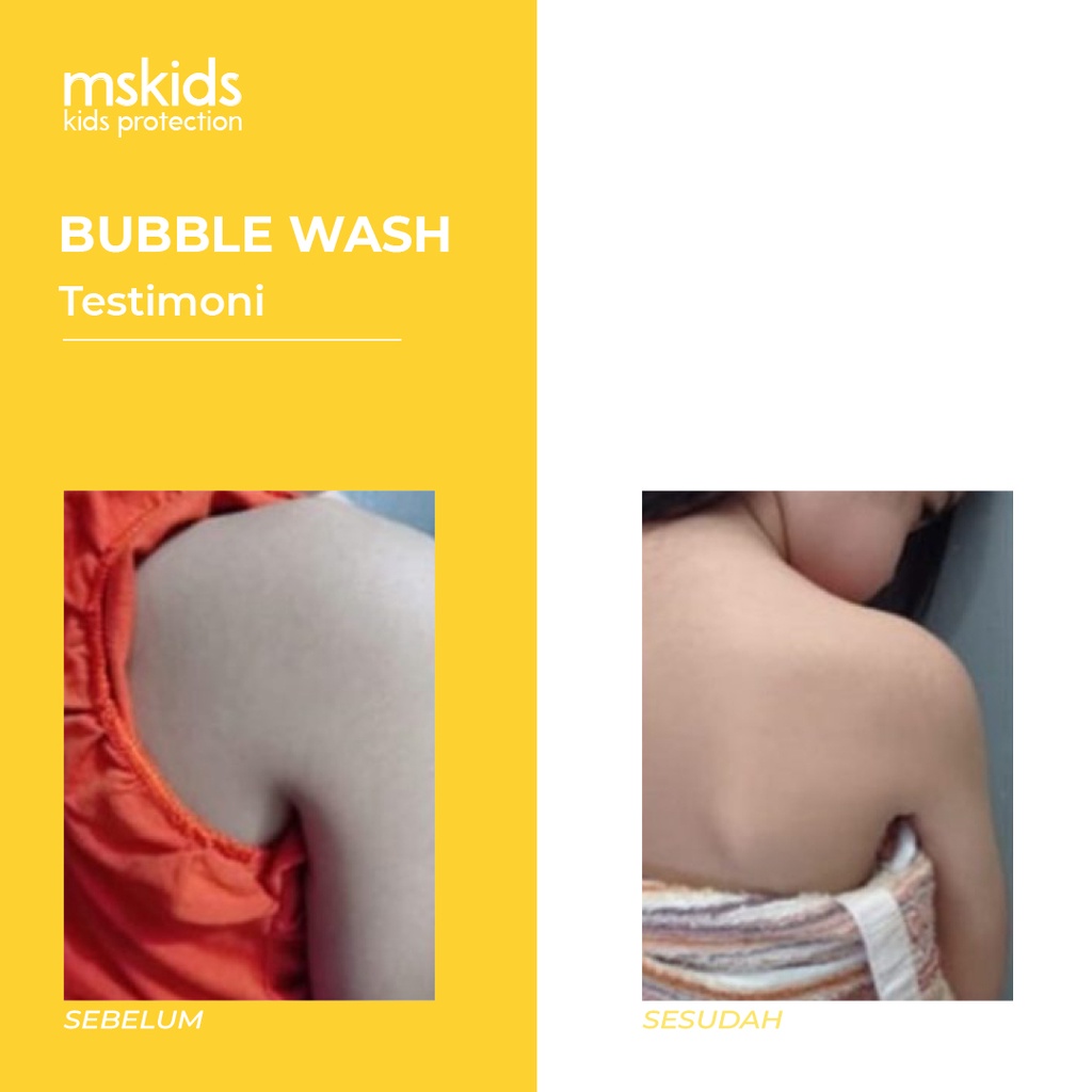 MS Glow Kids Original Bubble Wash MS Kids by ms.glowofficialbandung