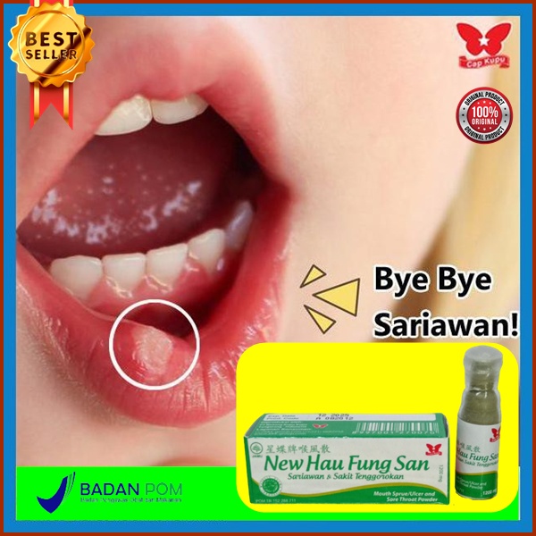 New hau fung san obat sakit tenggorokan nyeri sariawan tenggorokan kering bau mulut panas dalam BPOM