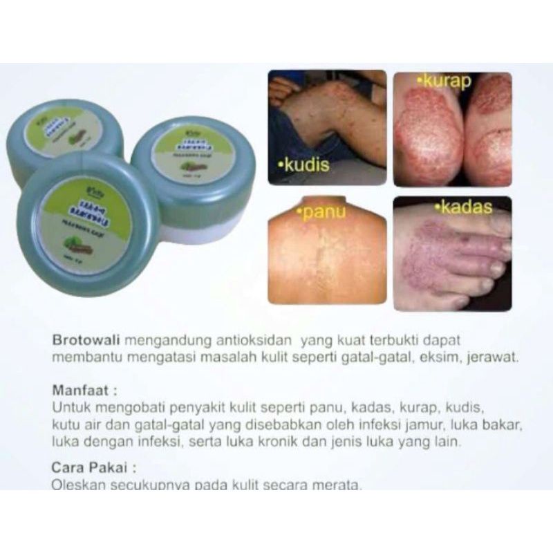 B'NYU CREAM BROTOWALI | TOTOL JERAWAT | SALEP BUAT GATAL, PANU, KADAS, KURAP, KUTU AIR, KUDIS, LUKA BAKAR