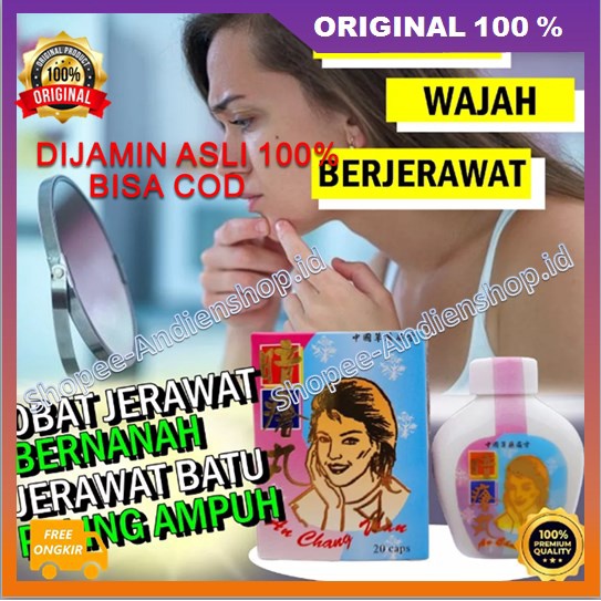 Obat Jerawat China Obat Penghilang Jerawat dan Darah Kotor Ampuh 100% ASLI
